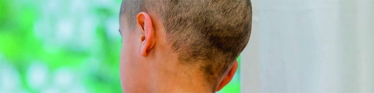 SAMHD1 – ett nytt terapeutiskt mål i jakt på bättre behandling mot AML