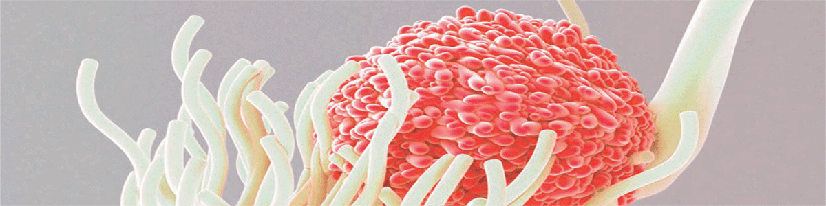 Nya framgångar med immunterapi vid ALL