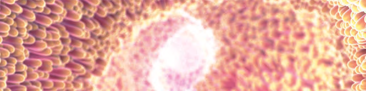 TARMCANCERSCREENING KAN RÄDDA LIV – nu ska Sverige starta införandet