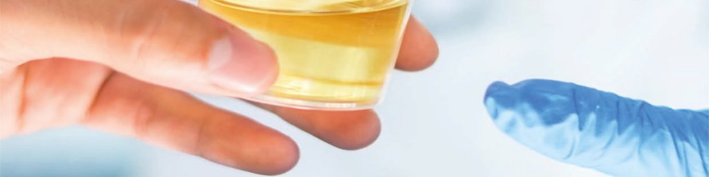 Nya möjligheter till handläggning av patienter med urinblåsecancer