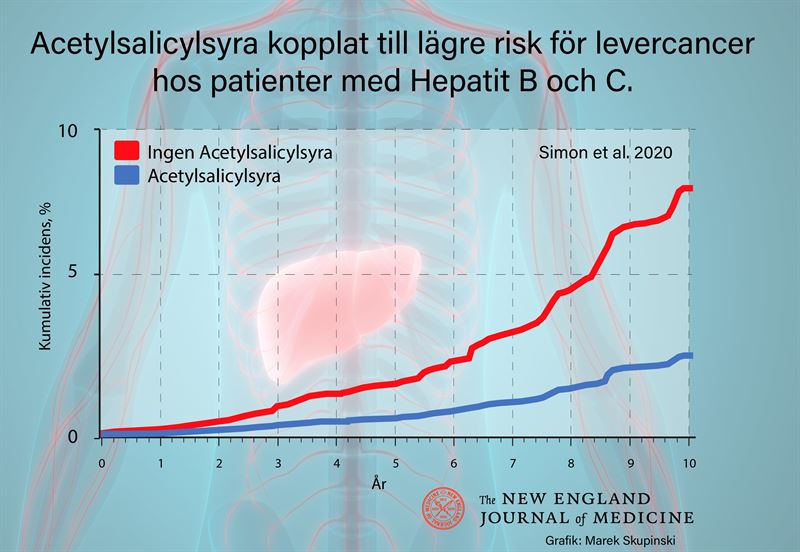 Acetylsalicylsyra kopplat till minskad levercancerrisk