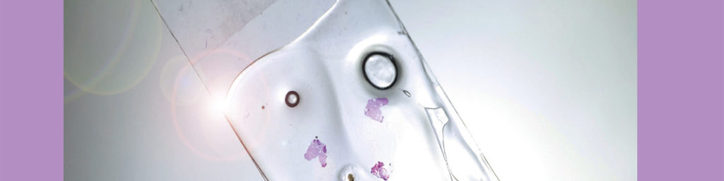 Nytt testsystem för bröstcancer avslöjar hur tumörens omgivning påverkar cancercellerna