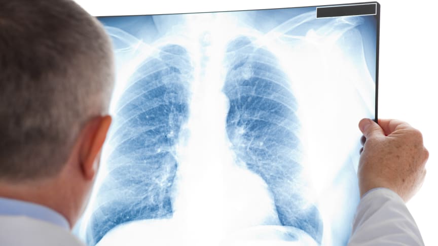 Minska lungcancer med rätt radonåtgärder