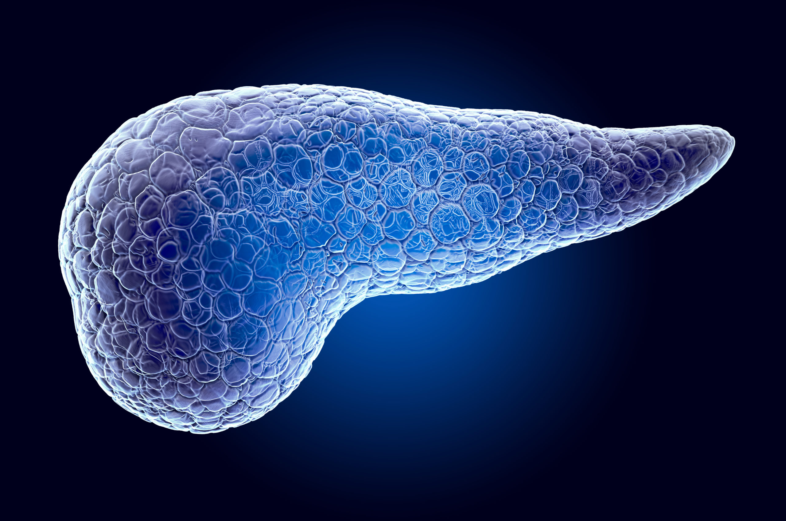 Borttagande av primärtumör vid spridd neuroendokrin bukspottkörtelcancer kan ge längre överlevnad