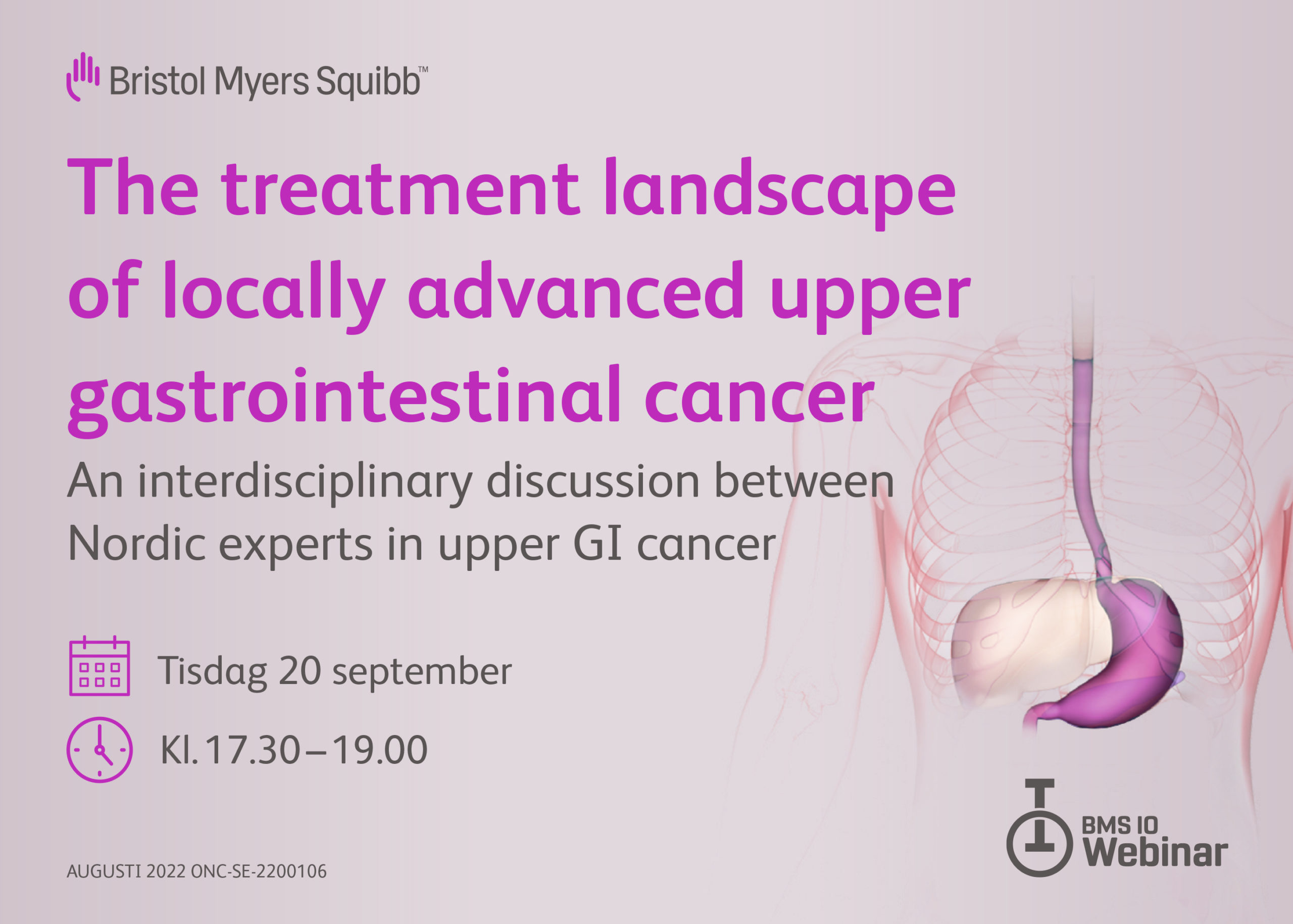 The treatment landscape of locally advanced upper gastrointestinal cancer