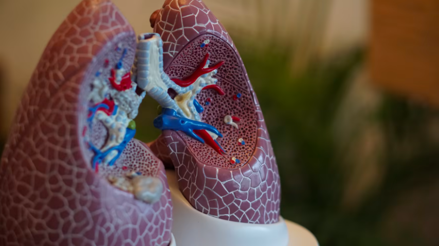 Pilotstudie kring lungcancerscreening: Fler potentiella cancerfall upptäckta än förväntat