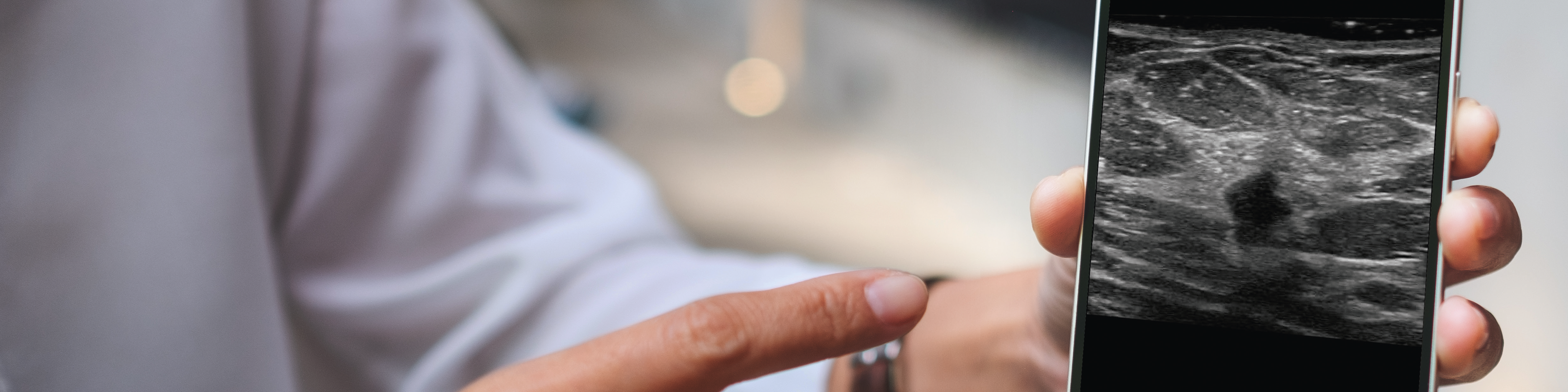 Smartare diagnostik av bröstcancer för länder med begränsade resurser