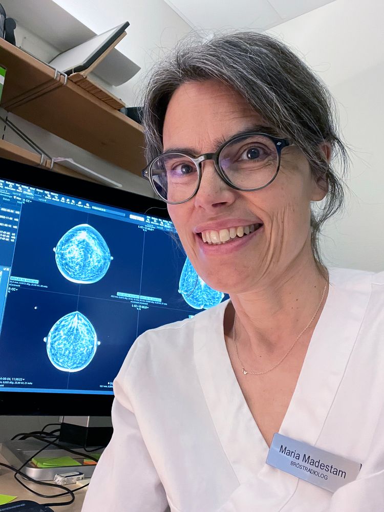 AI-stödd bröstcancerscreening: lovande resultat men många frågor ännu obesvarade