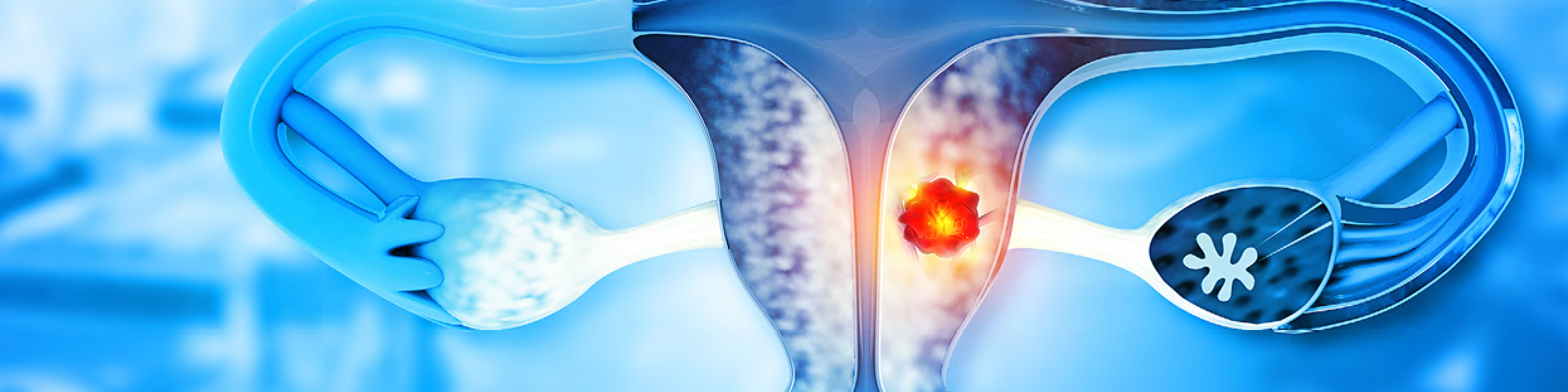 Miljonanslag till banbrytande forskning om äggstockscancer