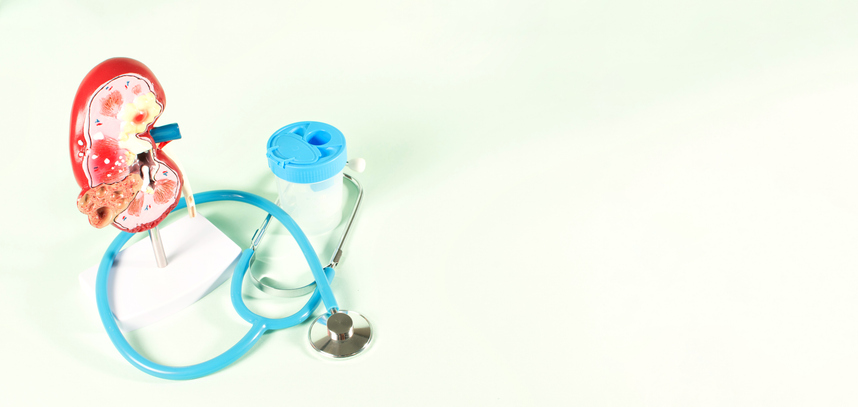 Fas 3-studie visade ökad överlevnad vid njurcancer