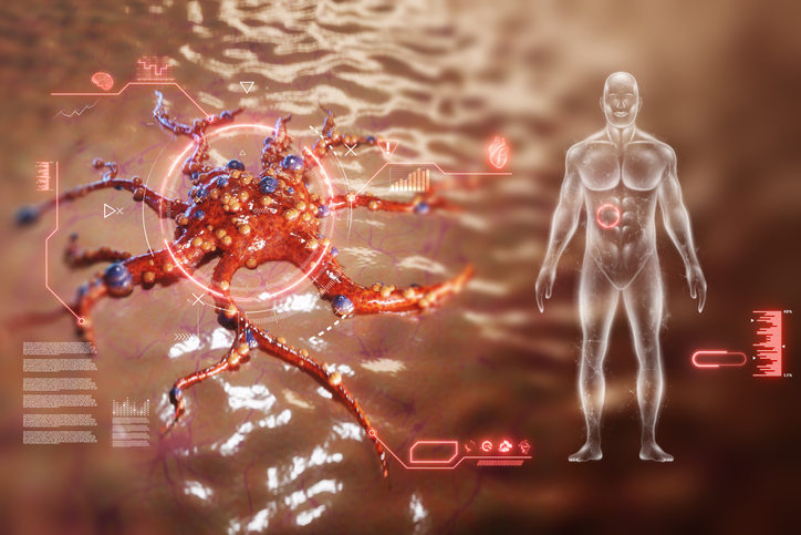 Kan artificiell intelligens öka den diagnostiska säkerheten vid pankreascancer?