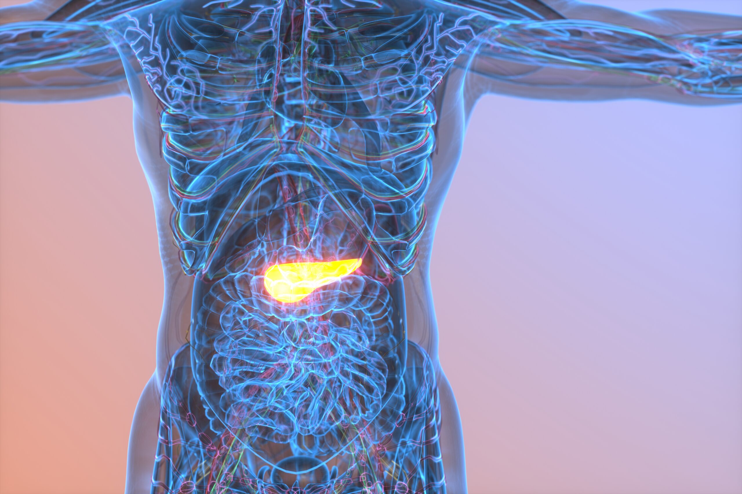 Uppmärksammat resultat med daraxonrasib för pankreascancer